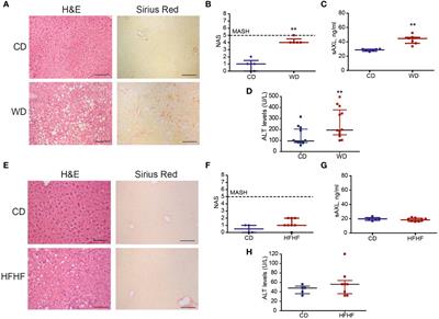 Dynamic changes in immune cell populations by AXL kinase targeting diminish liver inflammation and fibrosis in experimental MASH